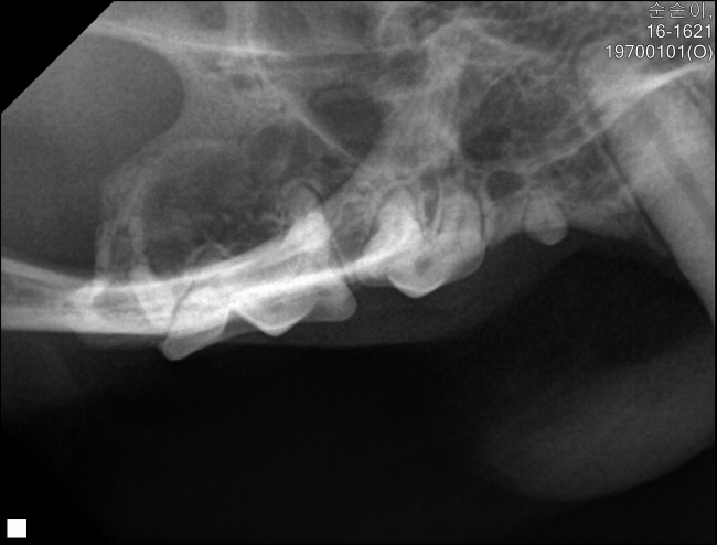 순순이-오른쪽위옆부분 발치전 치과방사선.jpg