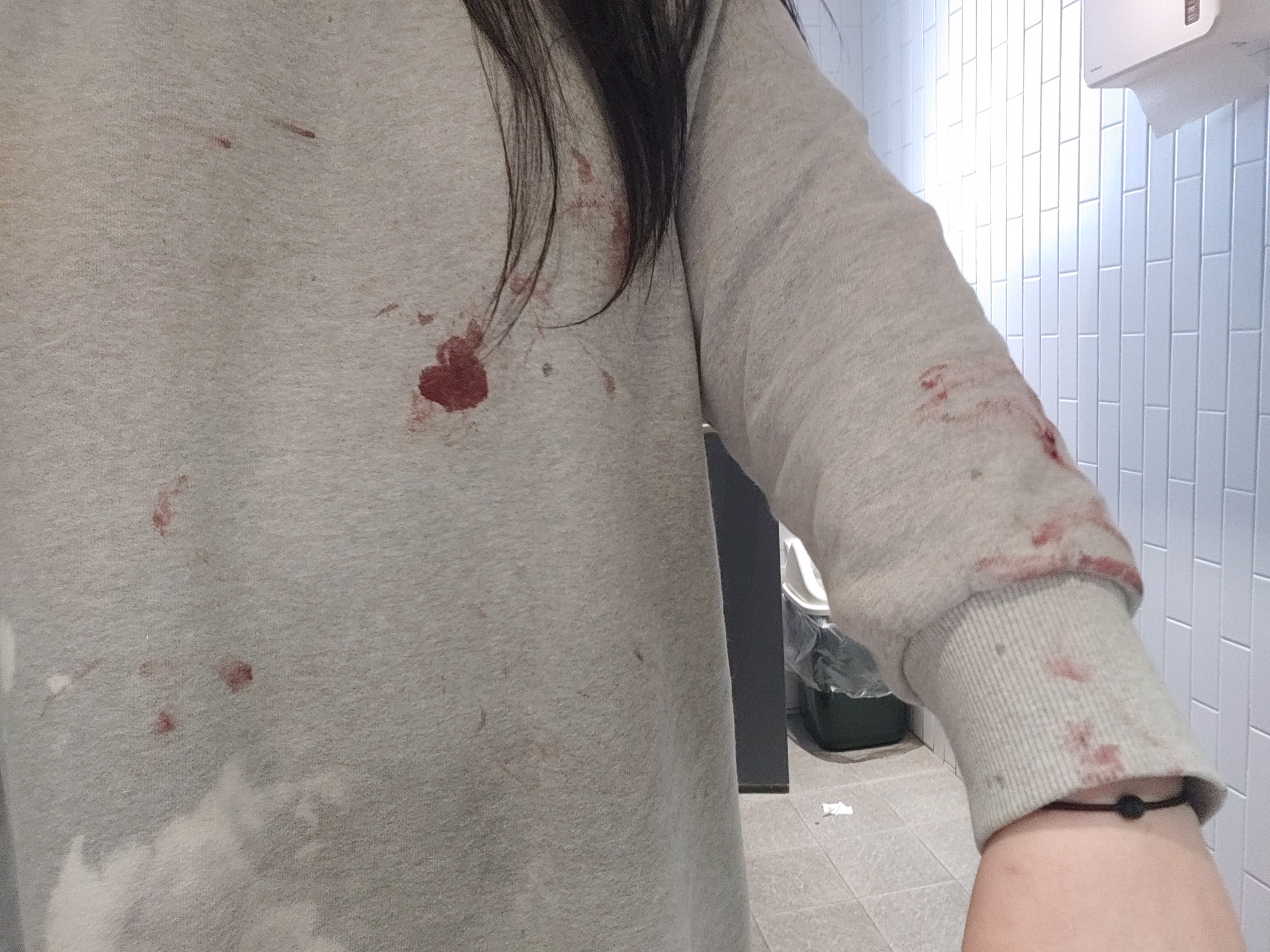 KakaoTalk_20250818_212147101_05.jpg