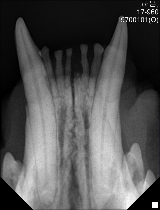 아래 앞니 엑스레이.jpg